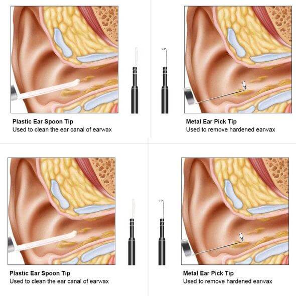 EarWax Camera